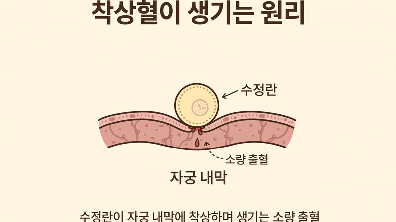 착상혈이 생기는 원리, 수정란이 자궁 내막에 착상하며 생기는 소량 출혈